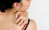 [ẢNH] Ăn dứa mùa hè (2): Dùng đúng cách để tránh 
