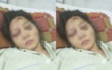 Toàn bộ vụ việc thai phụ 18 tuổi bị tra tấn dã man đến sảy thai ở TP.HCM