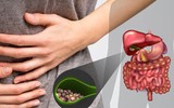 [ẢNH] Nhịn ăn sáng: Hệ luỵ kéo theo là các chứng bệnh 