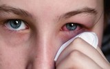 10 bệnh dễ lây nhiễm từ bể bơi và cách phòng tránh