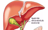 Những tác dụng không ngờ của quả óc chó