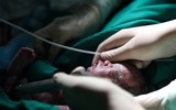 Cảm phục những người mẹ ung thư từ chối điều trị nhường sự sống cho con