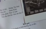 Khán giả nhặt sạn hài hước khó đỡ trong phim 
