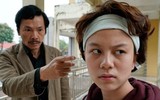 Lý giải nguyên nhân 