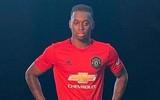 [ẢNH] MU: Ba 