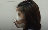 Hoại tử kinh hoàng trên cơ thể vì tiêm mỡ tự thân, chất làm đầy