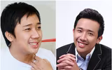 [Ảnh] Ngoại hình mới đầy bất ngờ của dàn ‘sao’ nam Việt sau phẫu thuật thẩm mỹ