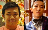 [Ảnh] Ngoại hình mới đầy bất ngờ của dàn ‘sao’ nam Việt sau phẫu thuật thẩm mỹ