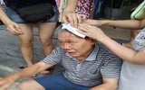 [ẢNH] Nguy hiểm rình rập ở những tòa chung cư cao tầng