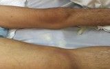 [ẢNH] Những điều cần biết về Whitmore- Bệnh truyền nhiễm có nguy cơ gây tử vong