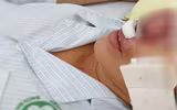 [ẢNH] Những điều cần biết về Whitmore- Bệnh truyền nhiễm có nguy cơ gây tử vong