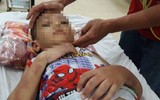 [ẢNH] Những vụ người thân bạo hành trẻ nhỏ gây bức xúc xã hội gần đây