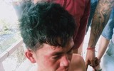 [ẢNH] Những vụ người thân bạo hành trẻ nhỏ gây bức xúc xã hội gần đây