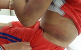 [ẢNH] Những vụ người thân bạo hành trẻ nhỏ gây bức xúc xã hội gần đây
