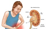 [ẢNH] Bất ngờ với những lợi ích thần kì của táo mà bạn chưa biết