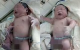 Ngắm những bé sơ sinh nặng nhất Việt Nam, sinh ra đã 