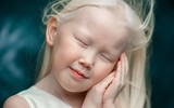 [ẢNH] Ngỡ ngàng trước vẻ đẹp khác biệt của những người mẫu bạch tạng nổi tiếng thế giới