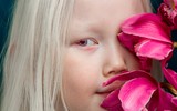 [ẢNH] Ngỡ ngàng trước vẻ đẹp khác biệt của những người mẫu bạch tạng nổi tiếng thế giới
