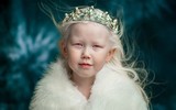 [ẢNH] Ngỡ ngàng trước vẻ đẹp khác biệt của những người mẫu bạch tạng nổi tiếng thế giới