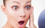 [ẢNH] Những hệ lụy không ngờ do những món ăn cay mang lại với cơ thể