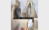 [ẢNH] Nhìn lại con đường sự nghiệp của 