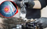 [ẢNH] Những thói quen sinh hoạt gây ung thư vú không ngờ tới
