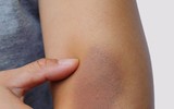 [ẢNH] 12 dấu hiệu bất thường trên cơ thể 