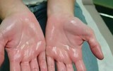 [ẢNH] 12 dấu hiệu bất thường trên cơ thể 