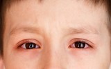 [ẢNH] 12 dấu hiệu bất thường trên cơ thể 