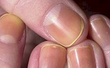 [ẢNH] 12 dấu hiệu bất thường trên cơ thể 