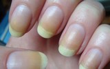 [ẢNH] 12 dấu hiệu bất thường trên cơ thể 
