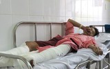[ẢNH] Các cách dập lửa do chập điện, dập cháy do xăng không phải ai cũng biết