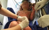 [ẢNH] Các cách dập lửa do chập điện, dập cháy do xăng không phải ai cũng biết