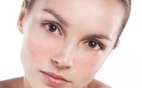 [ẢNH] Tác hại khôn lường của việc sử dụng mỹ phẩm kém chất lượng
