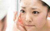 [ẢNH] Tác hại khôn lường của việc sử dụng mỹ phẩm kém chất lượng