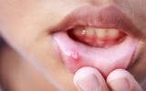 [ẢNH] Những dấu hiệu bất thường trên cơ thể cảnh báo ung thư sớm