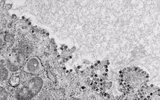 [ẢNH] Những con đường nhiễm bệnh không ngờ tới do virus corona gây ra