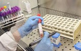 [ẢNH] Những phương án thuốc điều trị bệnh nhân mắc virus corona ở một số nước trên thế giới