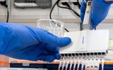 [ẢNH] Những phương án thuốc điều trị bệnh nhân mắc virus corona ở một số nước trên thế giới