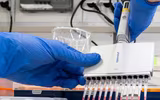 [ẢNH] Những phương án thuốc điều trị bệnh nhân mắc virus corona ở một số nước trên thế giới