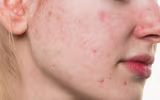 [ẢNH] Cảnh báo những căn bệnh dễ mắc phải khi trời nồm ẩm và cách phòng tránh