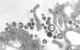 [ẢNH] Những loài động vật là ổ chứa tự nhiên của nhiều virus 