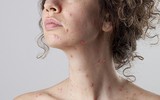[ẢNH] Cảnh báo những căn bệnh dễ mắc phải khi trời nồm ẩm và cách phòng tránh