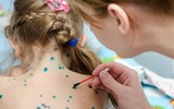 [ẢNH] Cảnh báo những căn bệnh dễ mắc phải khi trời nồm ẩm và cách phòng tránh