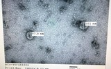 [ẢNH] Những phát hiện khoa học quan trọng của các nước về virus corona