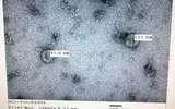 [ẢNH] Những phát hiện khoa học quan trọng của các nước về virus corona