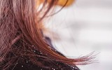 [ẢNH] Cảnh giác trước những hiểm họa từ thói quen để tóc ướt đi ngủ