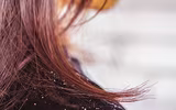 [ẢNH] Cảnh giác trước những hiểm họa từ thói quen để tóc ướt đi ngủ