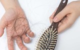 [ẢNH] Cảnh giác trước những hiểm họa từ thói quen để tóc ướt đi ngủ