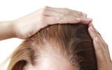 [ẢNH] Cảnh giác trước những hiểm họa từ thói quen để tóc ướt đi ngủ